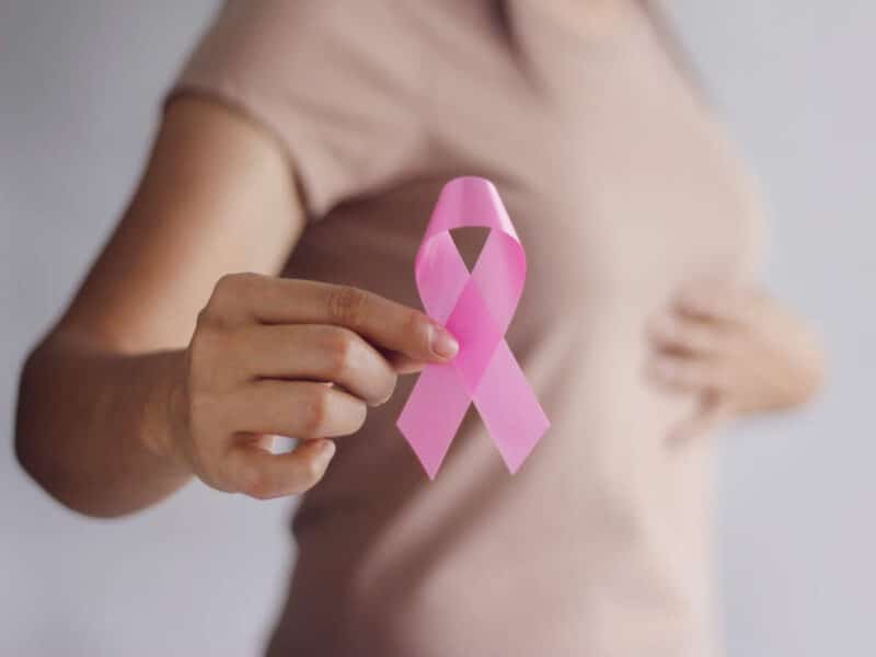 - Breast cancer 04 - ภาพที่ 3