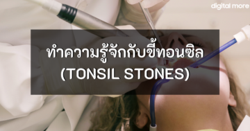 - tonsil stones cover - ภาพที่ 1