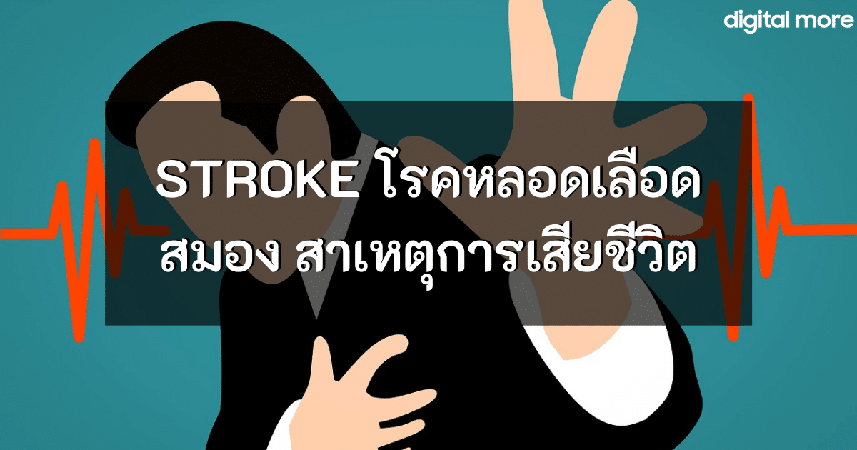 - stroke cover - ภาพที่ 1